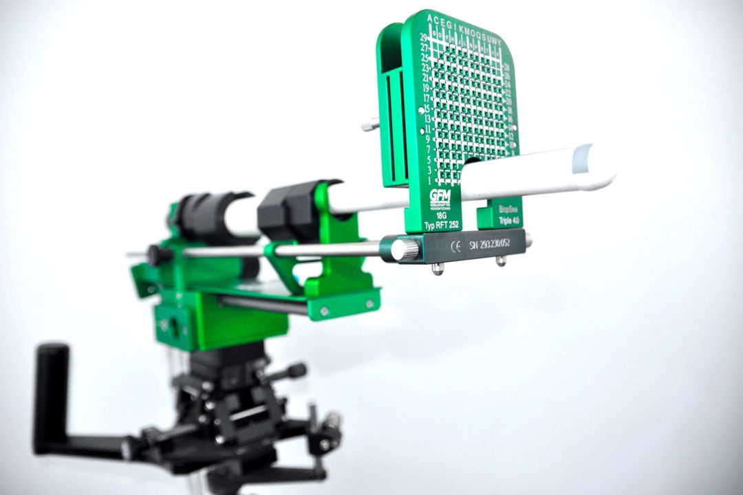 Διαπερινεϊκή Βιοψία Προστάτη