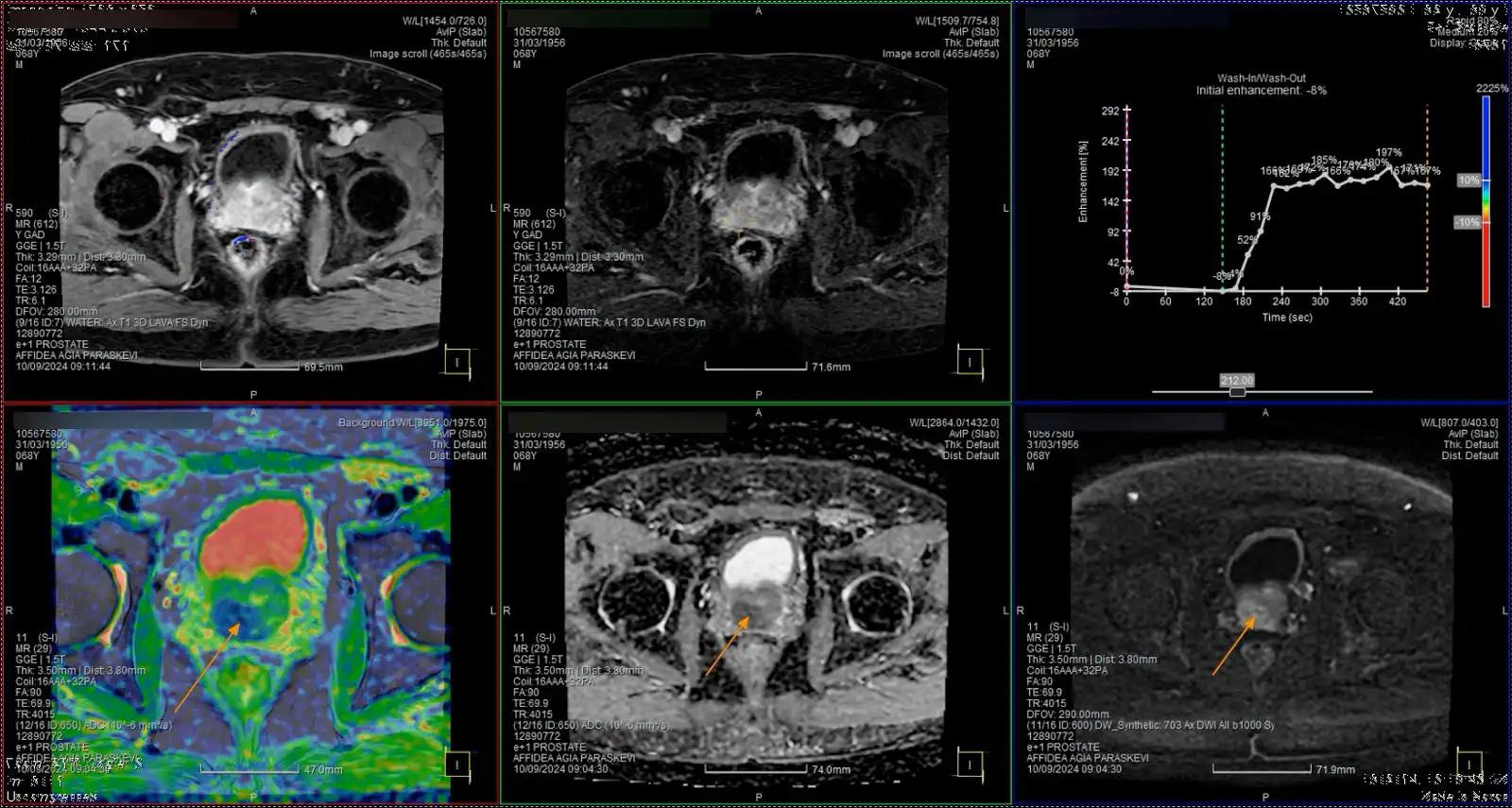 2025 09 25 08 59 55 271