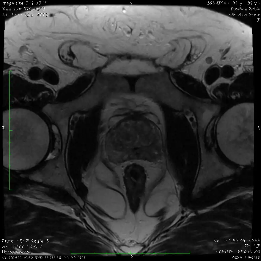 ax t2 fse 703 antigrapho